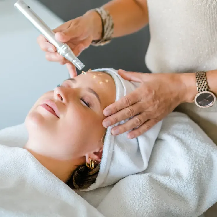Ewa Brunner führt den Microneedling-Pen über die Stirn einer Kundin.